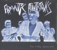 Preview: The X-Ray Sessions (CD) Preview: The X-Ray Sessions (CD)